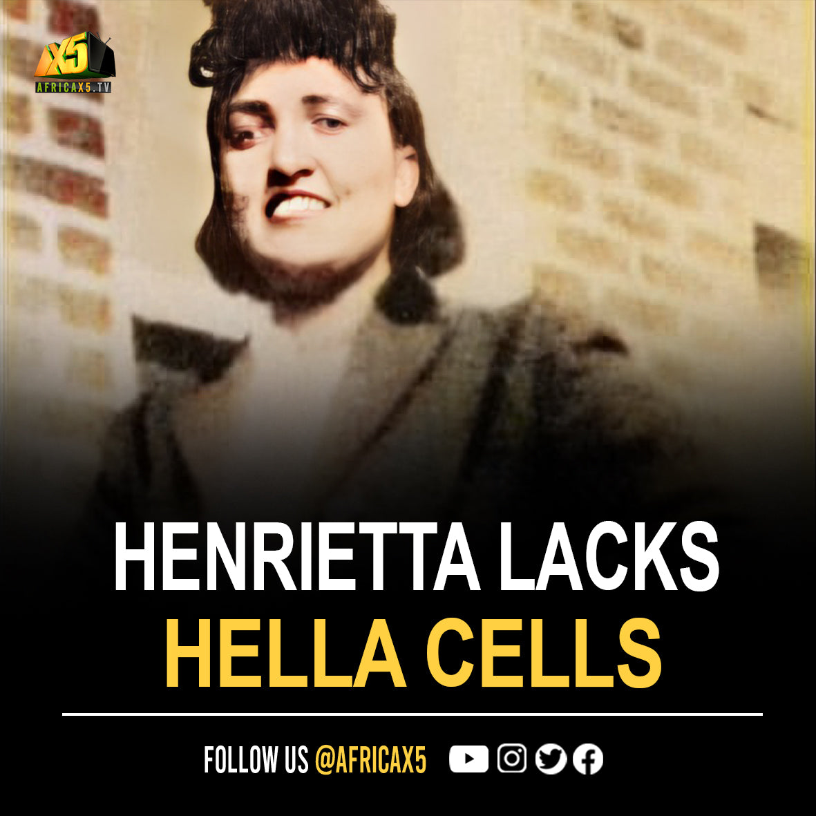 On October 4 th 1951, Henrietta Lacks died. Her cells were taken without her knowledge in 1951 (HeLa cells) and became one of the most important tools in medicine.